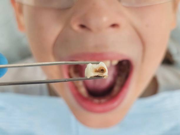 Best Broken or Chipped Tooth Repair in Wrangell, AK